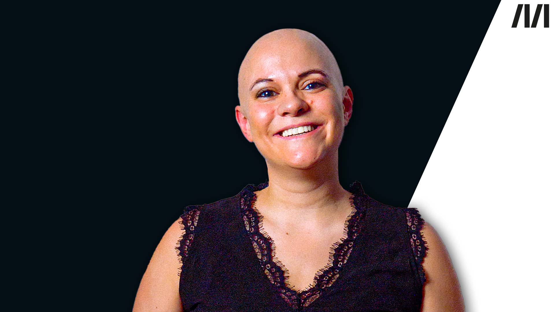 Man sieht eine Frau mit Glatze in die Kamera grinsen. Sie spricht über die Krankheit Alopezie: Wie ist es, als Frau mit Glatze zu leben?