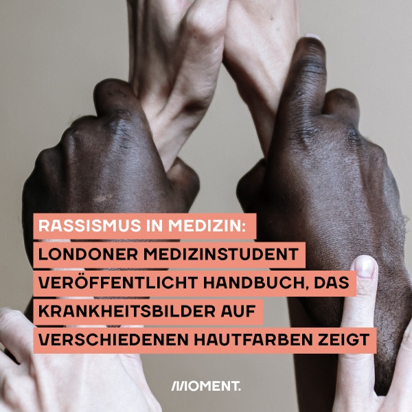 Foto zeigt weiße und schwarze Hände, die sich gegenseitig berühren. Rassismus in der Medizin: Londoner Medizinstudent veröffentlich Handbuch, das Krankheitsbilder auf verschiedenen Hautfarben zeigt.